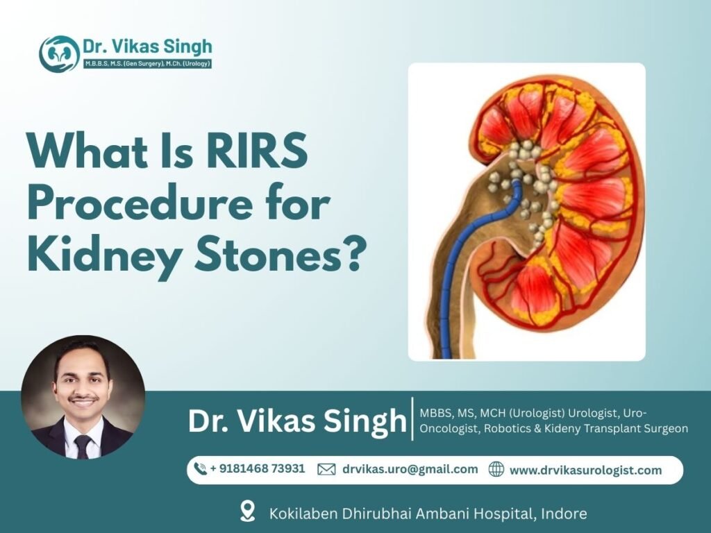 RIRS Procedure for Kidney Stones in Indore – Advanced Laser Treatment by Urologist