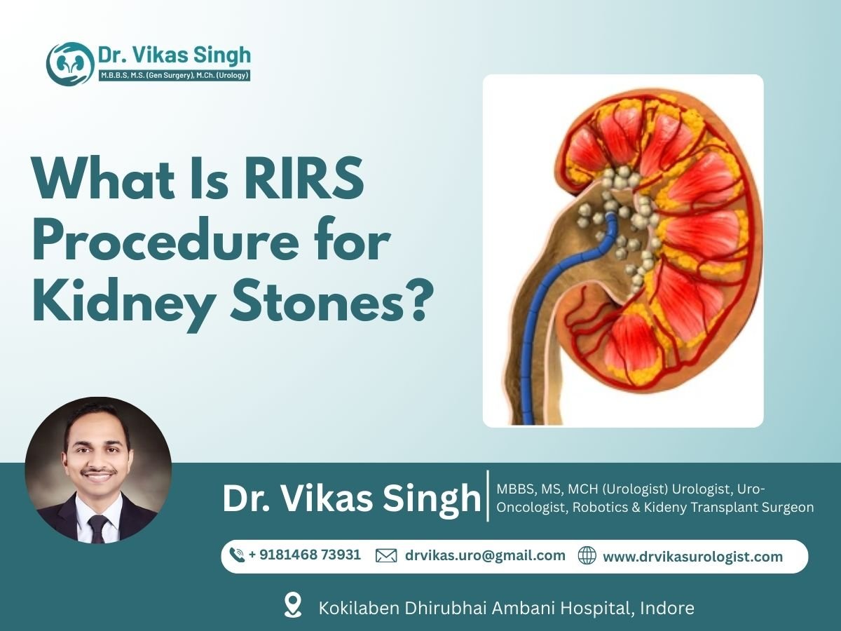 RIRS Procedure for Kidney Stones in Indore – Advanced Laser Treatment by Urologist