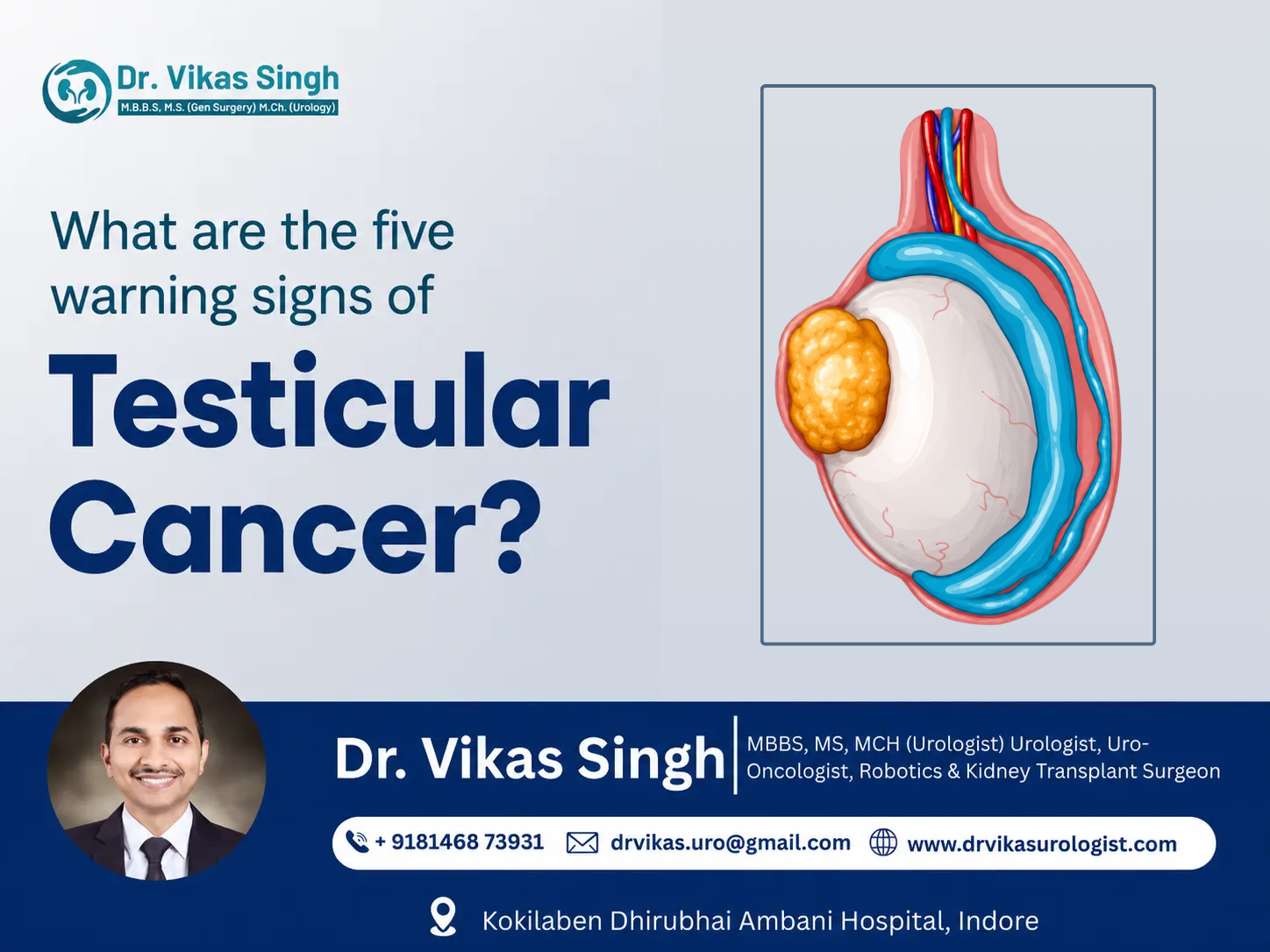 Signs of Testicular Cancer