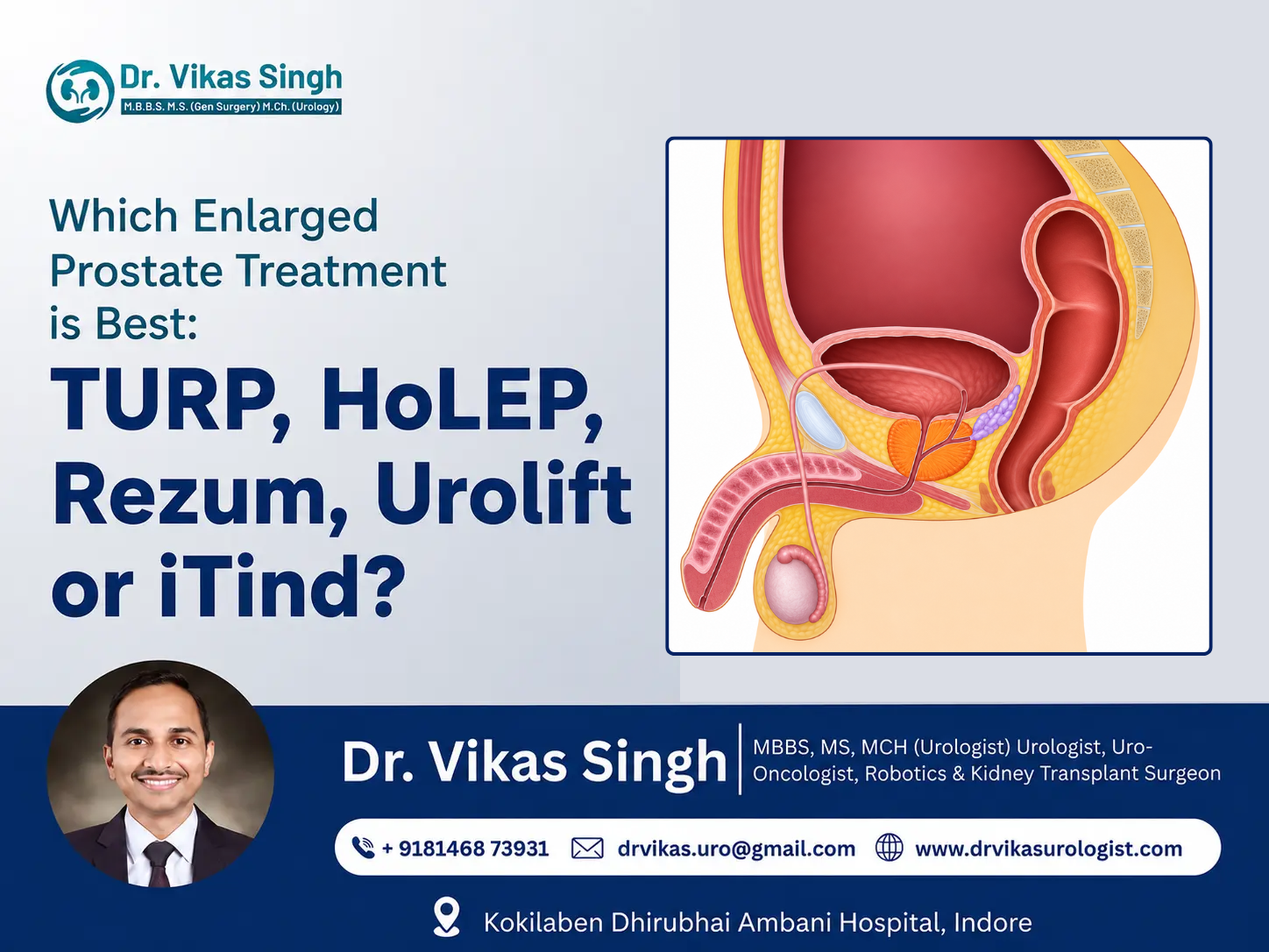 Which Enlarged Prostate Treatment Is Best