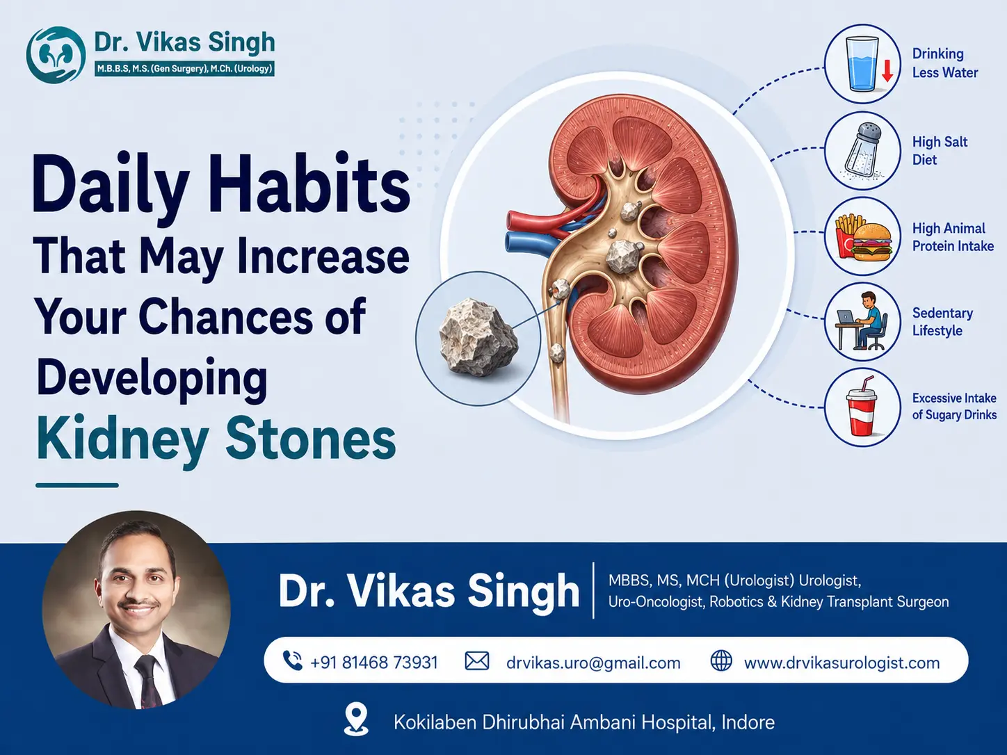 Daily habits that may increase your chances of developing kidney stones, including low water intake, high salt, high animal protein, inactivity, and sugary drinks