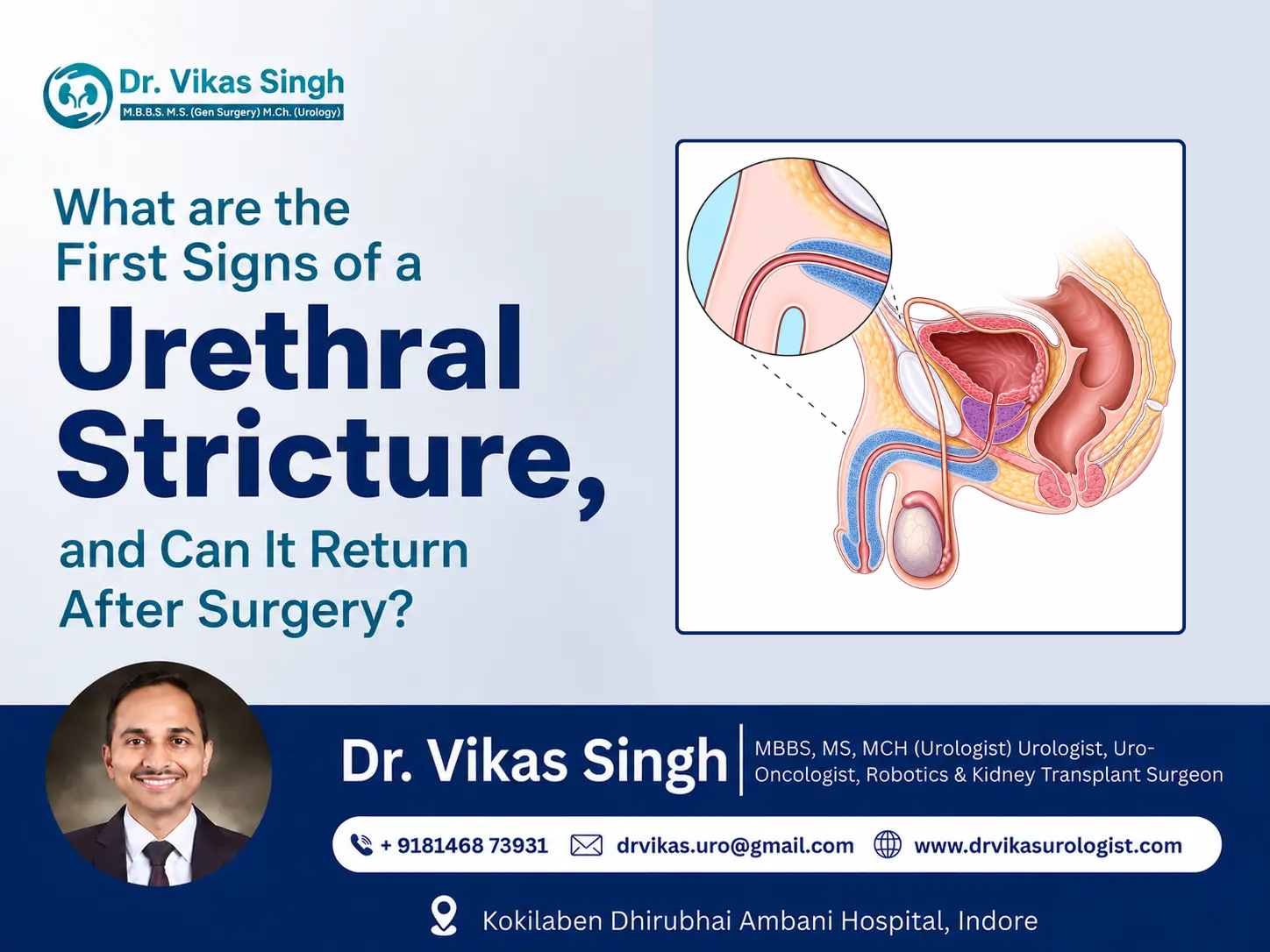signs of a urethral stricture
