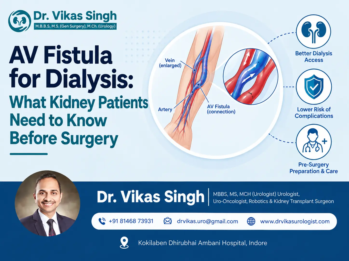 AV Fistula for Dialysis showing the connection between an artery and vein in the arm, with the enlarged vein providing vascular access for dialysis