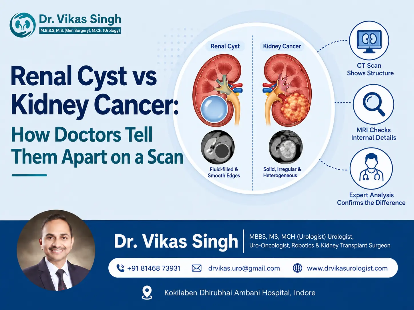 Renal cyst vs kidney cancer showing kidney imaging differences on CT and MRI scans