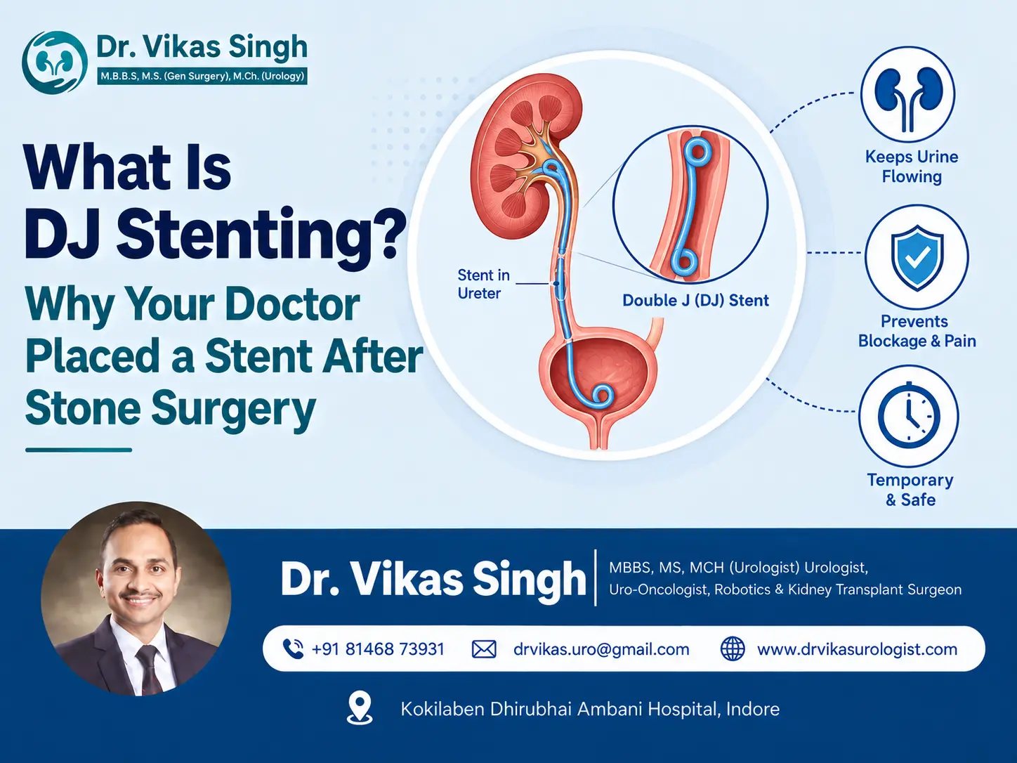 Educational graphic explaining DJ stenting, showing a double J stent inside the ureter between the kidney and bladder, with its purpose after stone surgery.